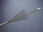Image: The Evolution Duodenal controlled-release stent (Photo courtesy of Cook Medical).
